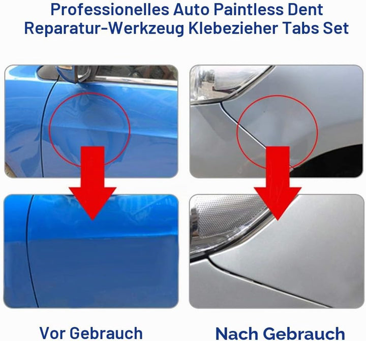 Keenso Auto Karosserie Dellenreparatur Saugnapf Set, 30 Stk Auto Dellenentferner Ausbeulen Saugnapf