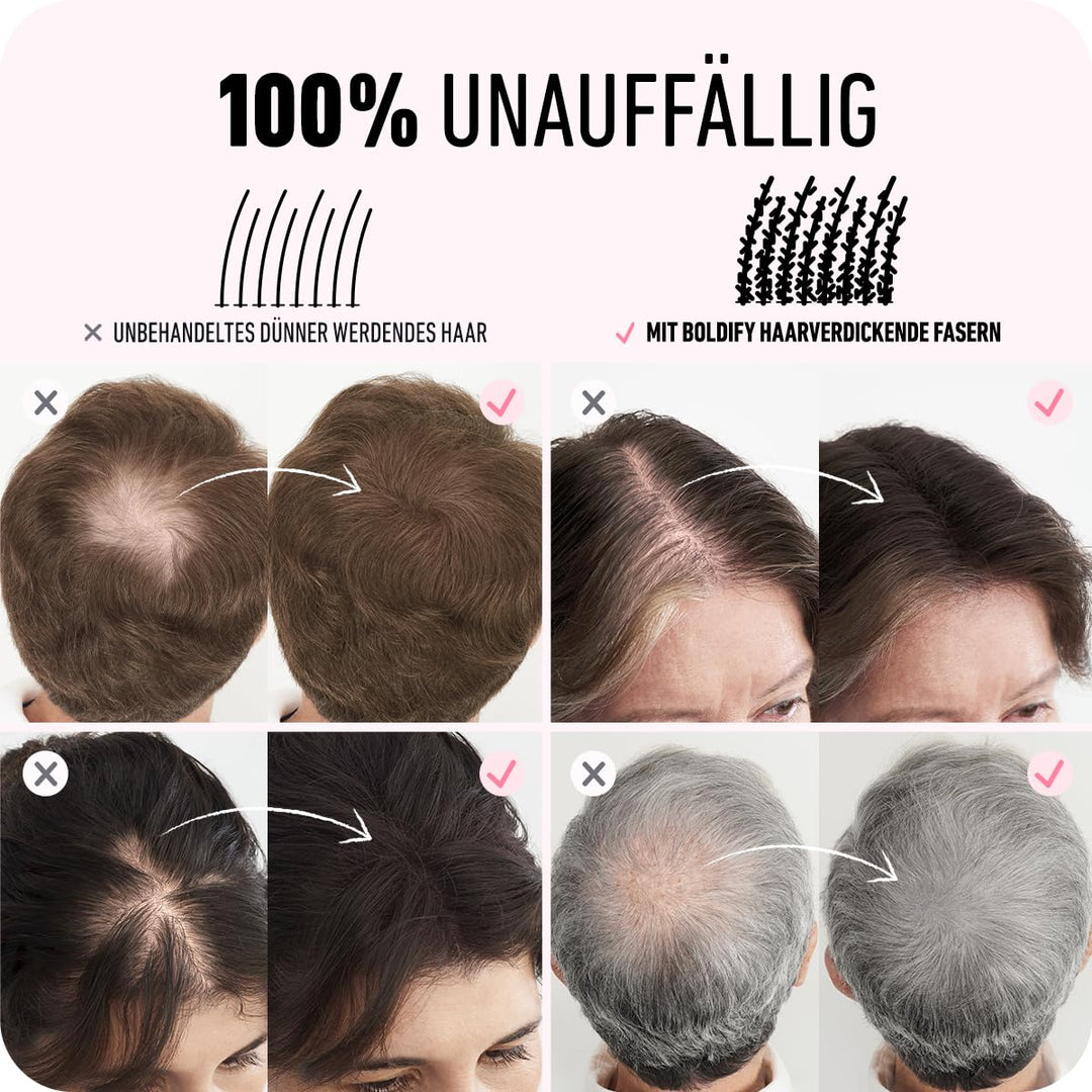BOLDIFY Streuhaar für Dünner Werdendes Haar (Aschbraun), Unsichtbar, Natürlich, Grosse Flasche, 28g,