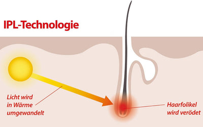 Sichler Beauty Laser Haarentferner: IPL-Haarentfernungs-System, 2 Aufsätze, Display, 5 Stufen,Schutz