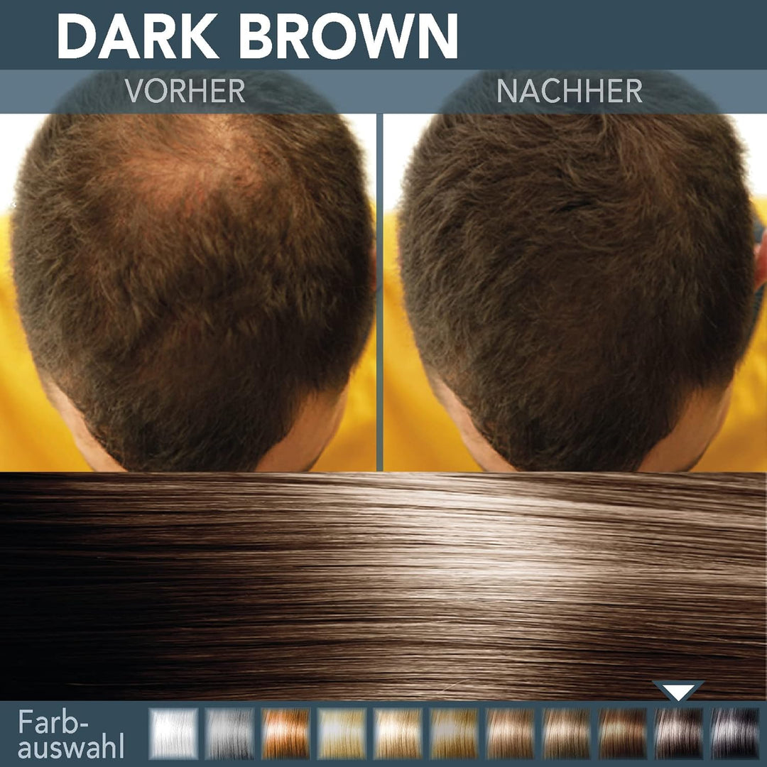 COVER HAIR - Premium Streuhaar 30g | Schütthaar zur Haarverdichtung und Ansatzkaschierung | Authenti