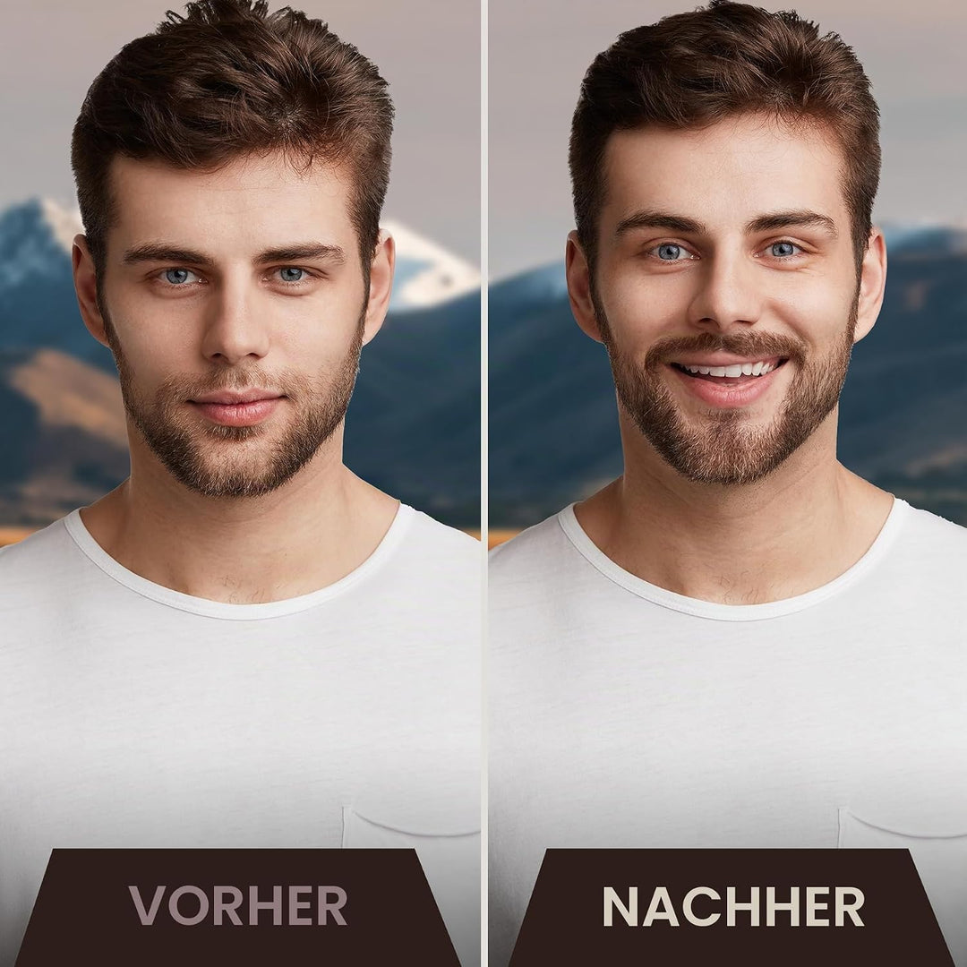 Striking Viking Bartwuchsöl mit Biotin - Verdickendes und pflegendes Bartöl für Bartwuchs - natürlic