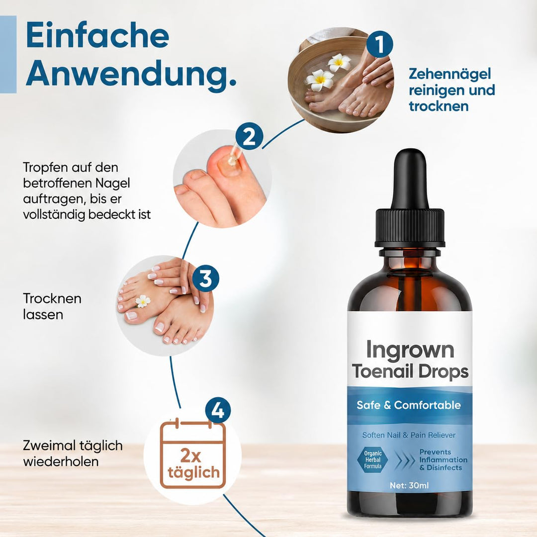 Eingewachsene ZehennäGel Tropfen, Korrekturtropfen | FüR Eingewachsene ZehennäGel, Schnell Wirkende