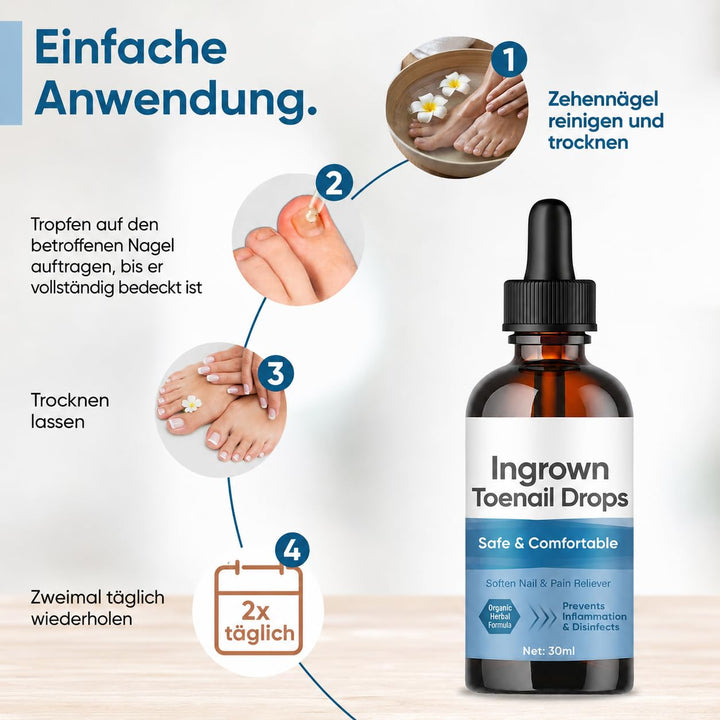Eingewachsene ZehennäGel Tropfen, Korrekturtropfen | FüR Eingewachsene ZehennäGel, Schnell Wirkende