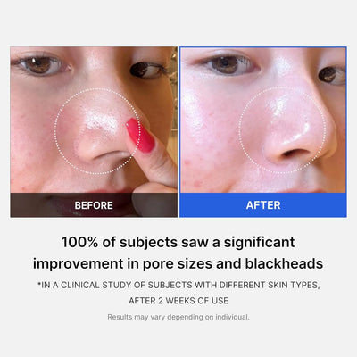 Medicube Zero Pore Pad 2.0 155g (70 Pads)