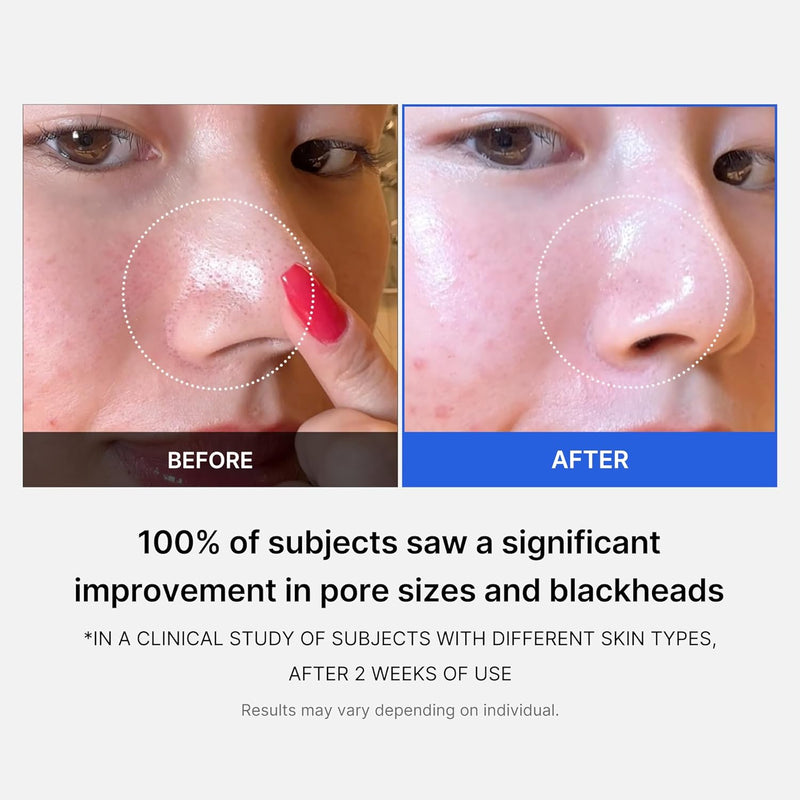 Medicube Zero Pore Pad 2.0 155g (70 Pads)