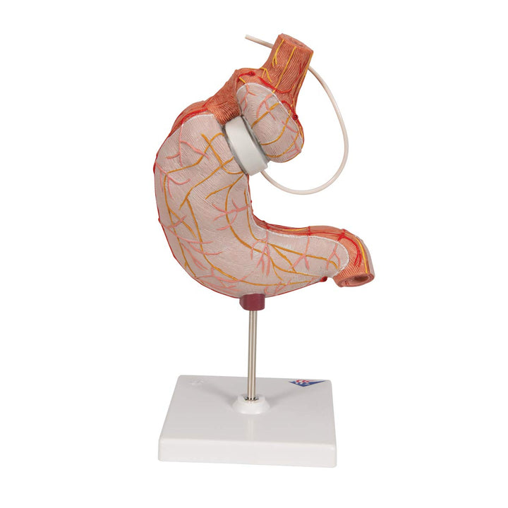 3B Scientific Menschliche Anatomie - Magenbandmodell + kostenlose Anatomie App - 3B Smart Anatomy