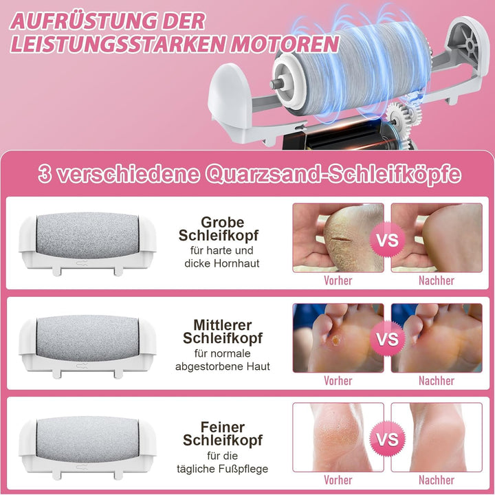Hornhautentferner Elektrisch Einstellbare Geschwindigkeit, AOMEES Elektrischer Hornhautentferner mit