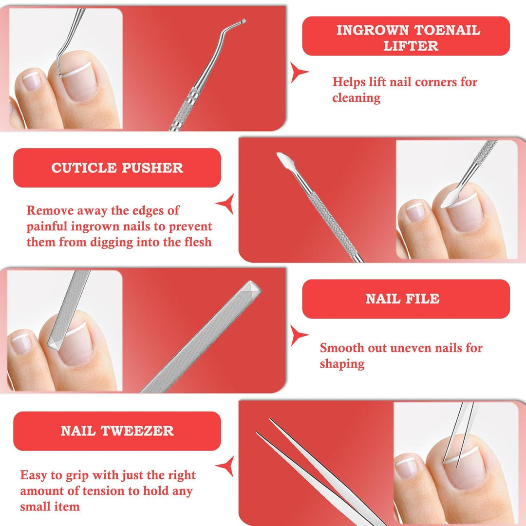 Ingrown Toenail Treatment, ELALRAU Ingrown Toenail Removal Kit with Ingrown Toenail Corrector Drops,