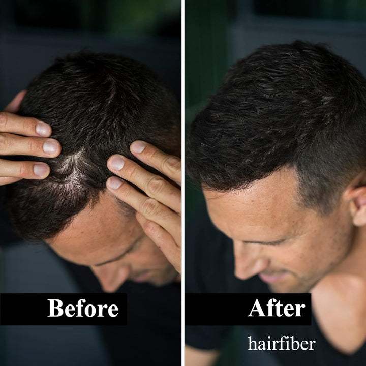 LEON MIGUEL Hair Fiber - Haarverdichtung - Premium Streuhaar/Schütthaar mit Soforteffekt bei Geheimr