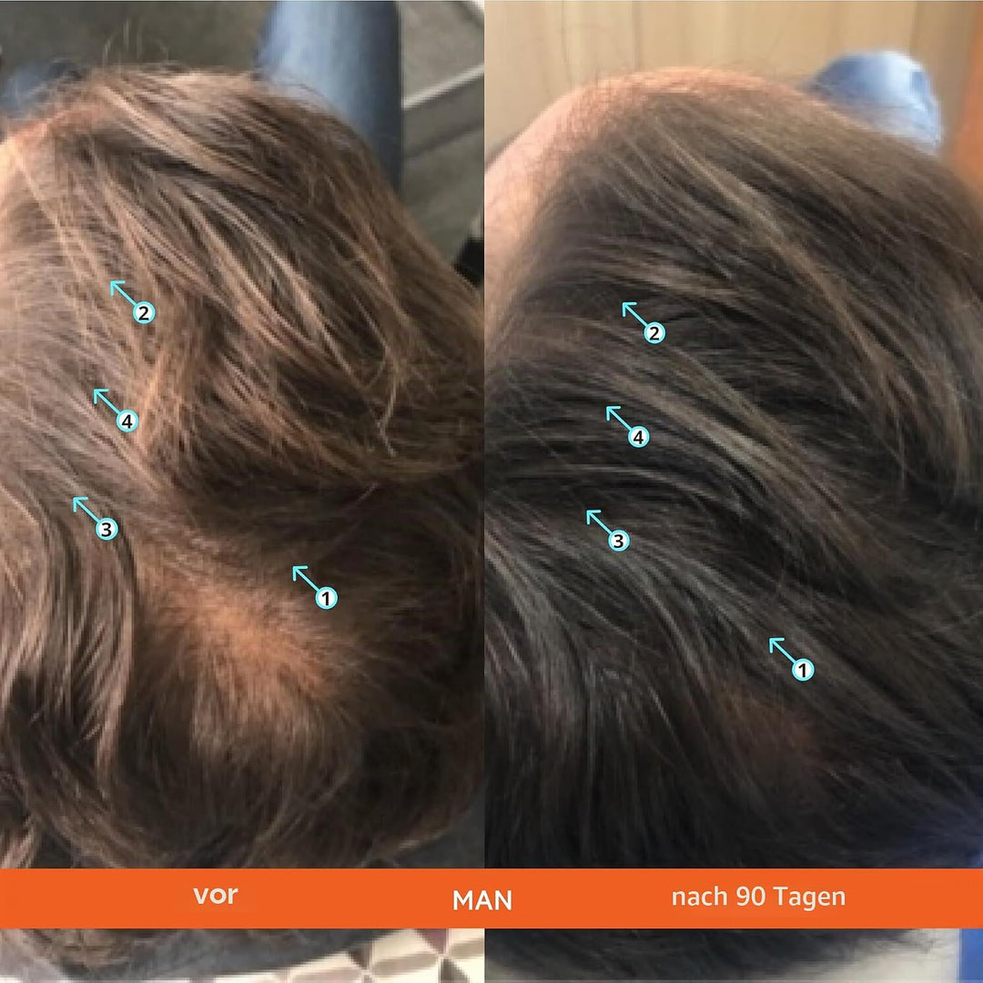 Revita Shampoo und Conditioner für dünner werdendes Haar, unterstützt das Wachstum, stärkt und verdi