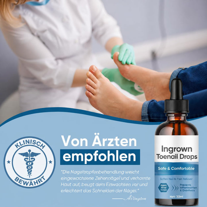 Eingewachsene ZehennäGel Tropfen, Korrekturtropfen | FüR Eingewachsene ZehennäGel, Schnell Wirkende