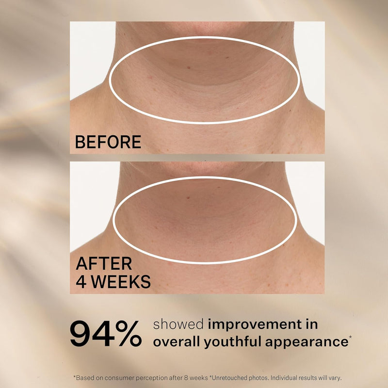 StriVectin TL Advanced™ Tightening Neck Cream PLUS, 1.0 oz for Tightening and Firming Neck & Décolle