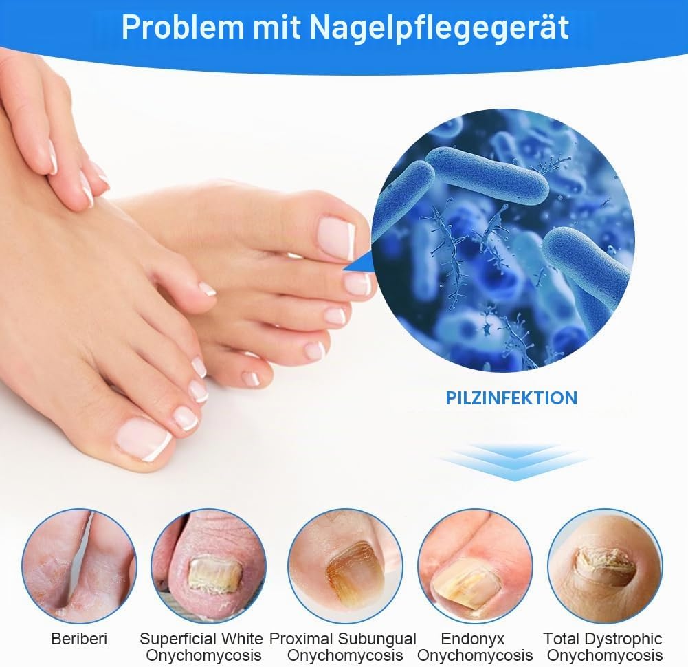 Nagelpilz Laser Gerät mit Zeitanzeige, Lichttherapiegerät für Nagelpilz, Nagelpilz-Laser, Nagelpilz