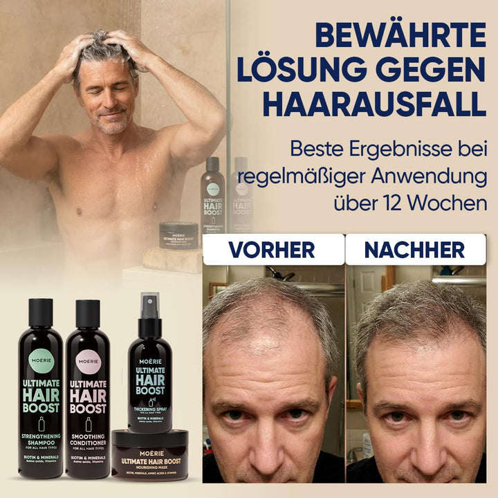 MOERIE Shampoo Set - gegen Haarausfall, Conditioner, Haarwachstum Serum & Haarmaske - natürlich Haar