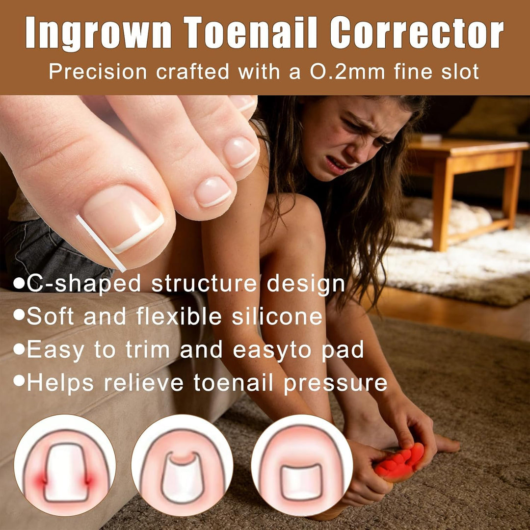 Joycabin Eingewachsene Zehennägel Set, Zehennagel-Heber, Zehennagelheber Werkzeugset, Nagelspangen Z