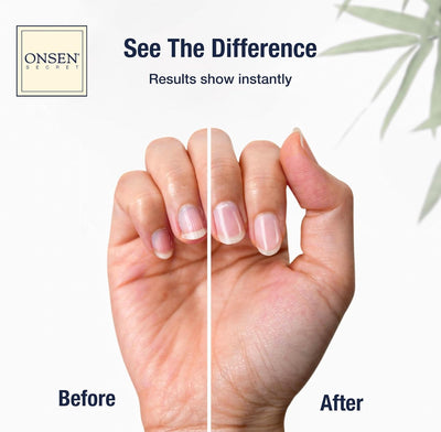 Reparaturcreme für Nagelhaut (30ml) Onsen - Feuchtigkeitspflege für Trockene Nagelhaut - Tiefenpfleg
