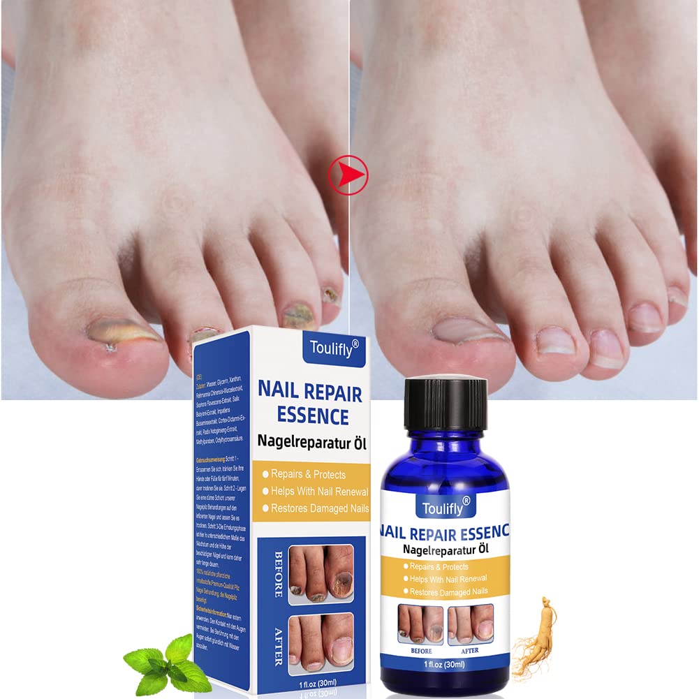 Nagelpflege und Behandlung, Nagelpflege für gesunde Fuss und Hand, Nagelpflegeöl,Nagelpflege pflegen