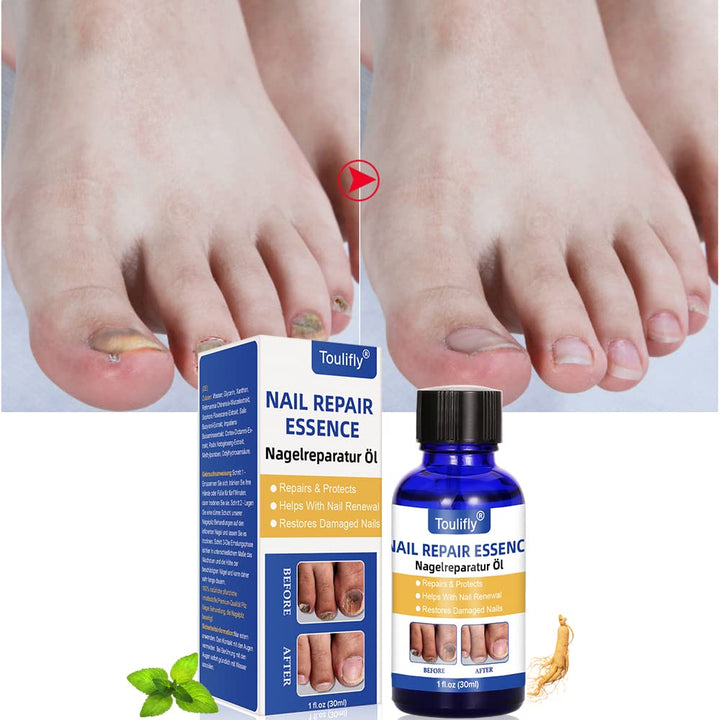 Nagelpflege und Behandlung, Nagelpflege für gesunde Fuss und Hand, Nagelpflegeöl,Nagelpflege pflegen