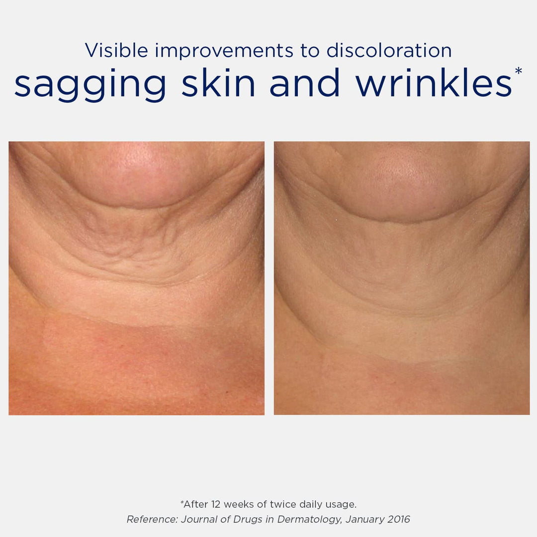 NeoStrata Skin Active Triple Firming Neck Cream Creme, 80 g