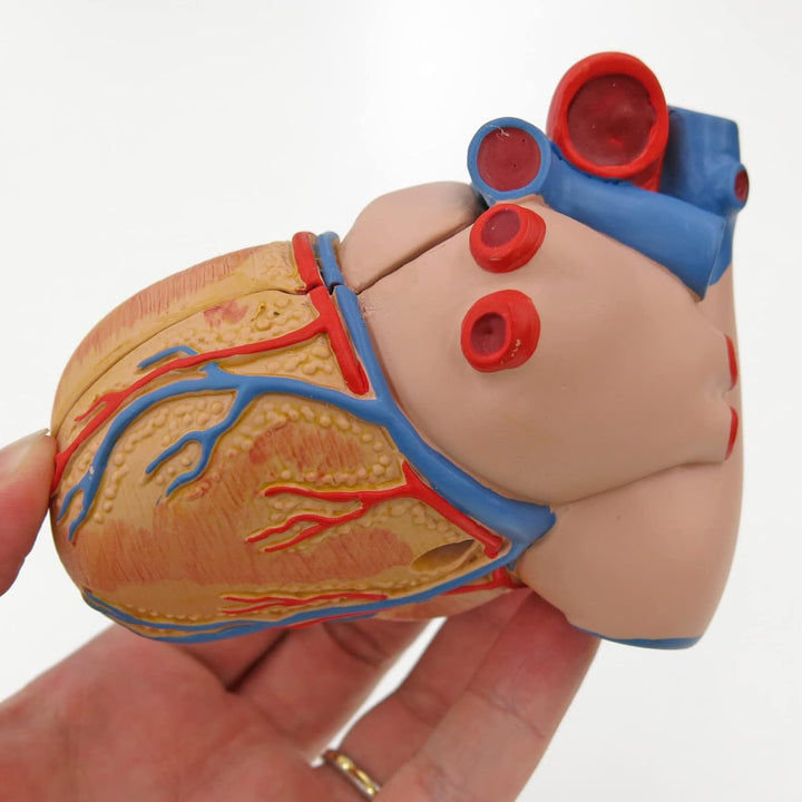3B Scientific Menschliche Anatomie - Klassik-Herzmodell mit linksventrikulärer Hypertrophie (LVH), 2