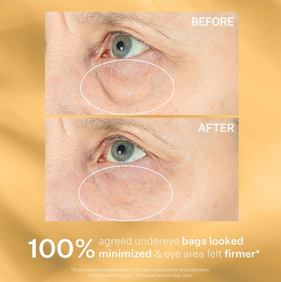 StriVectin Hyperlift Eye Instant Eye Fix0 milliliter Vanilla