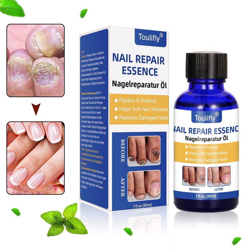Nagelpflege und Behandlung, Nagelpflege für gesunde Fuss und Hand, Nagelpflegeöl,Nagelpflege pflegen