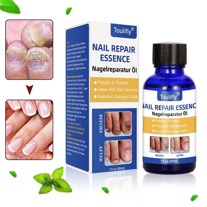 Nagelpflege und Behandlung, Nagelpflege für gesunde Fuss und Hand, Nagelpflegeöl,Nagelpflege pflegen