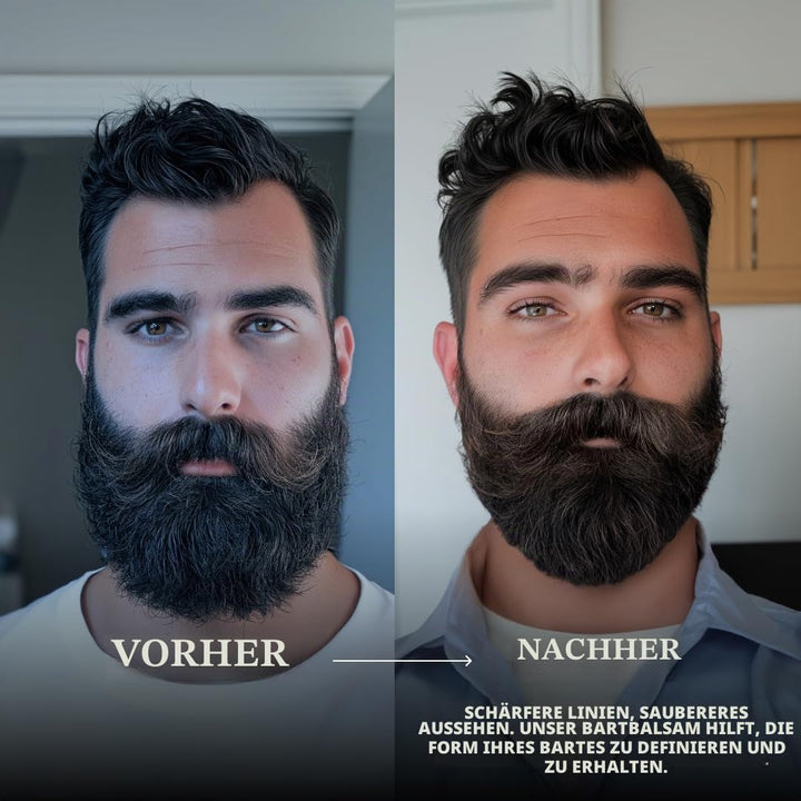 AOVSHEY Bartöl 60ML Beard Oil Bartwuchsöl, Bartwuchsmittel für einen kräftigen Bart, für die Pflege