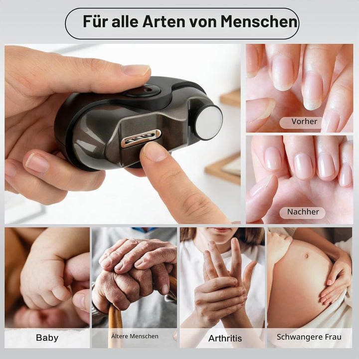 Elektrischer Nagelknipser für Senioren – 2025 Neu Nagelfräser mit LED, 3 Geschwindigkeitsstufen, Ult