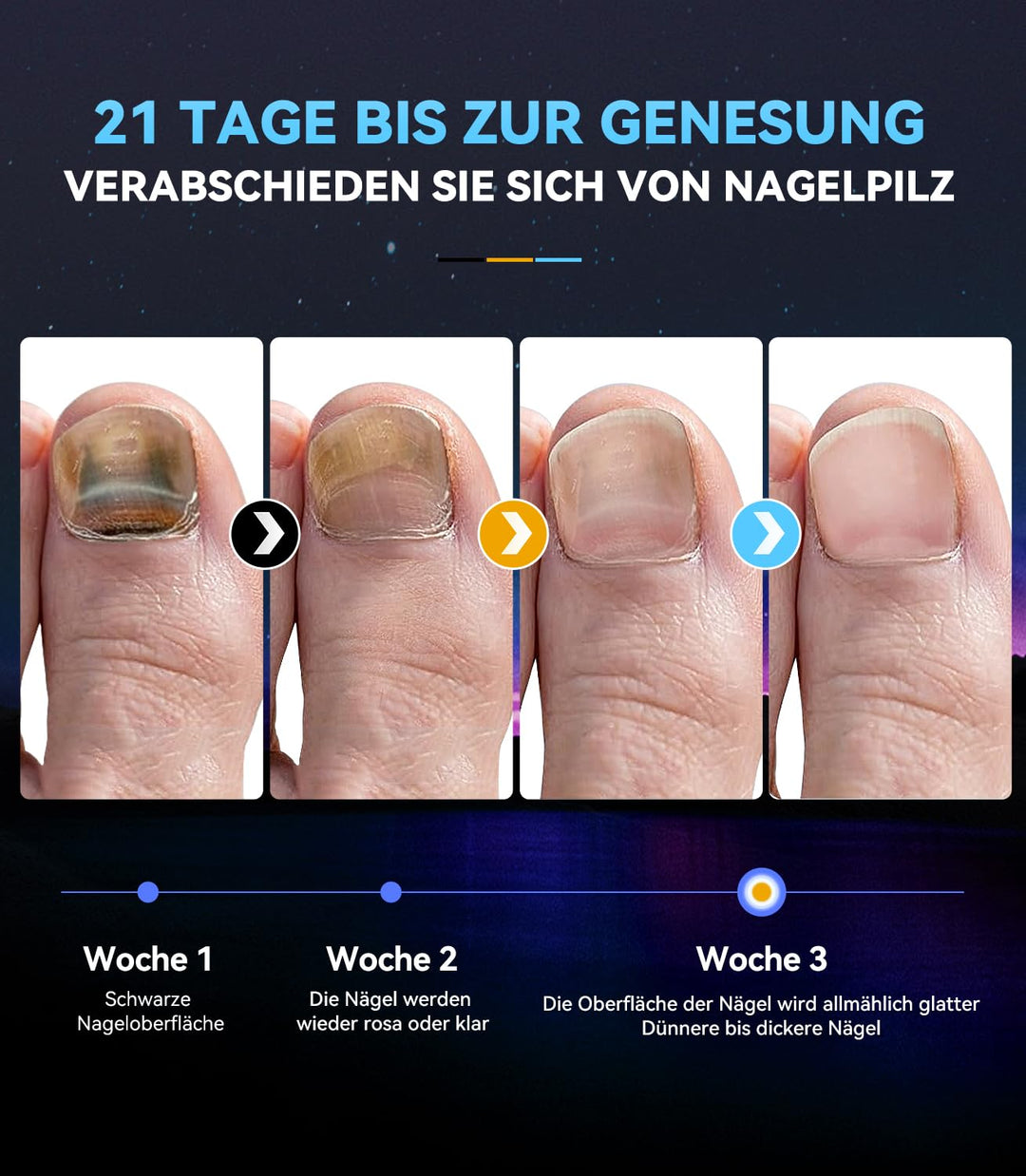 6.0 Nagelpilz Laser mit Zeitmessgerät Nagelpilz Lasergerät【3 Blau 1 Infrarot-Stärkste Wirkung】Laser
