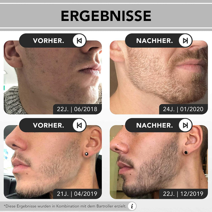 Anthony Brown® Bartwuchsmittel Männer - belegte Wirkung durch Capilia Longa für mehr Bartwuchs - Bar