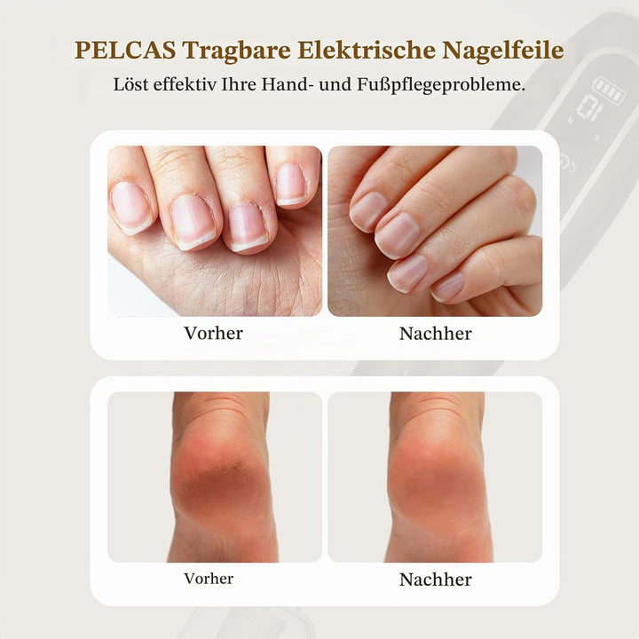 PELCAS Elektrische Nagelfräser 10 Geschwindigkeiten Schnurloser Nagelbohrer Professionell Nagelschle