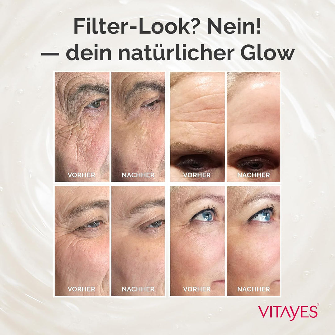 VITAYES Instant Ageback - Anti Aging Creme, Soforteffekt gegen Falten, Tränensäcke und schlaffe Haut