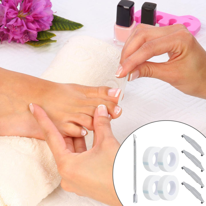 4 Stück Eingewachsene Zehennägel Set Fussnagel Eingewachsen Spange Nagelspangen Für Fussnägel Zehenn