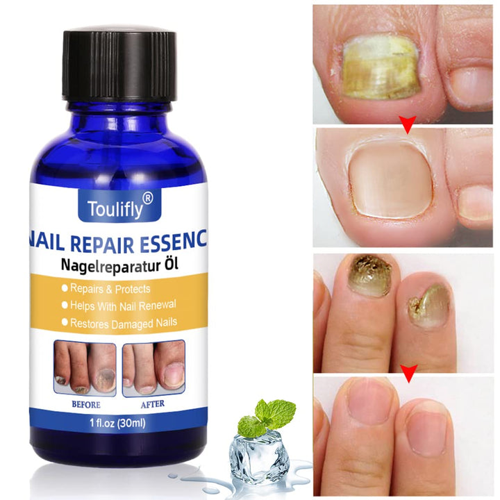 Nagelpflege und Behandlung, Nagelpflege für gesunde Fuss und Hand, Nagelpflegeöl,Nagelpflege pflegen