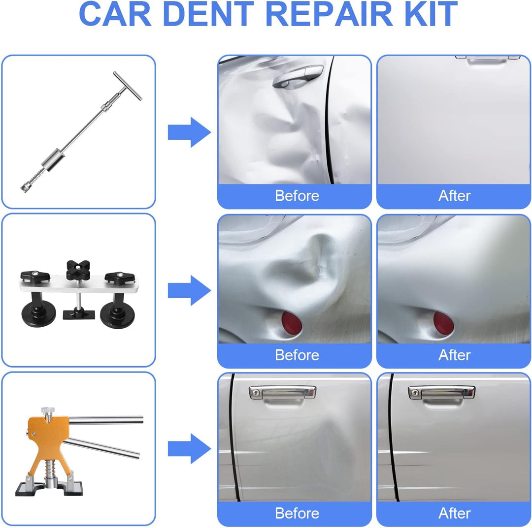 Fybitlilian 97pcs Auto Reparatur Ausbeulwerkzeug Lackfreies Dent Puller Set Dellen Reparaturset Auto