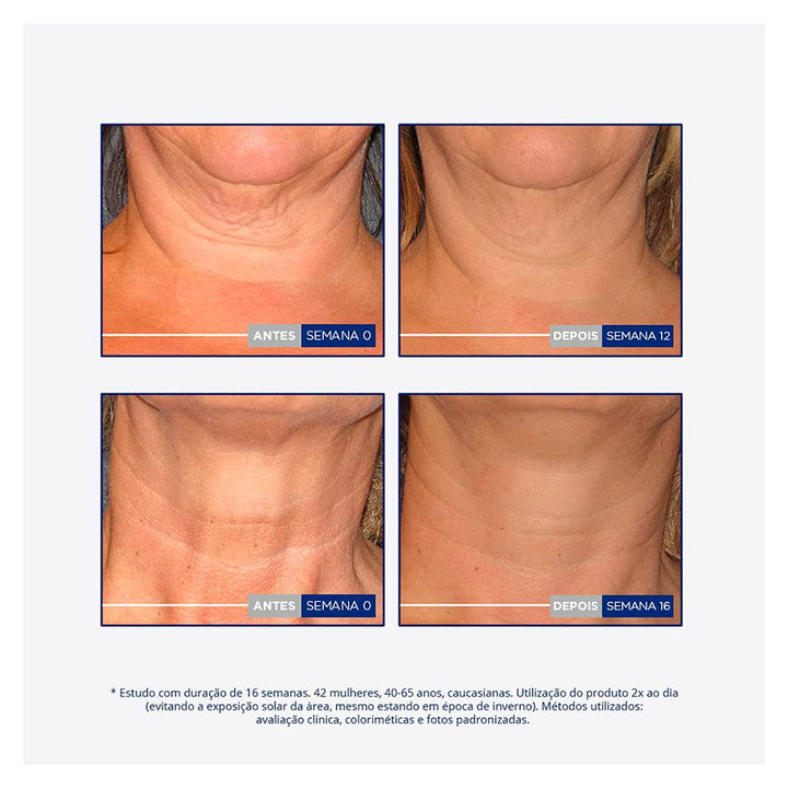 Neostrata Skin Act Reaf Cuello Escot 80G