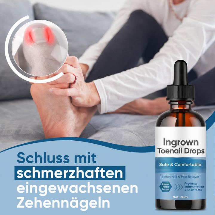 Eingewachsene ZehennäGel Tropfen, Korrekturtropfen | FüR Eingewachsene ZehennäGel, Schnell Wirkende