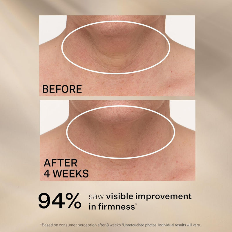 StriVectin TL Advanced™ Tightening Neck Cream PLUS, 1.0 oz for Tightening and Firming Neck & Décolle