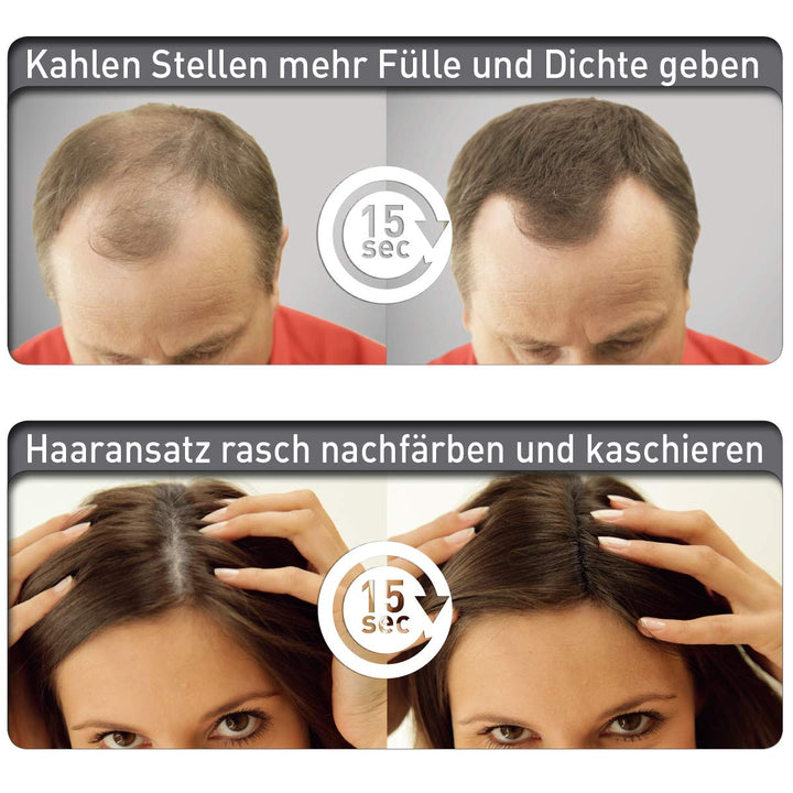 COVER HAIR - Starter Set aus 30g Streuhaar in Dunkelbraun und Fixierspray, 100ml - zur sekundenschne