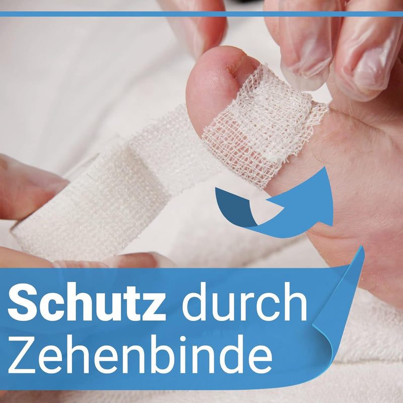 Kosmetex Set Tamponade 5 mtr, 1x Tamponierhaken, 1x Zehenbinde, Nagelfalztamponade für eingewachsene