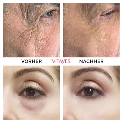 VITAYES Skincare Set Vegan - Instant Ageback 15 ml Mit Soforteffekt - Perfector Augenserum 15 ml - A