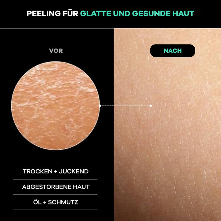 Dermasuri Tiefenpeeling-Rückenschrubber – Peeling-Badetuch – Duschschwamm Mit Zwei Texturen – Wieder