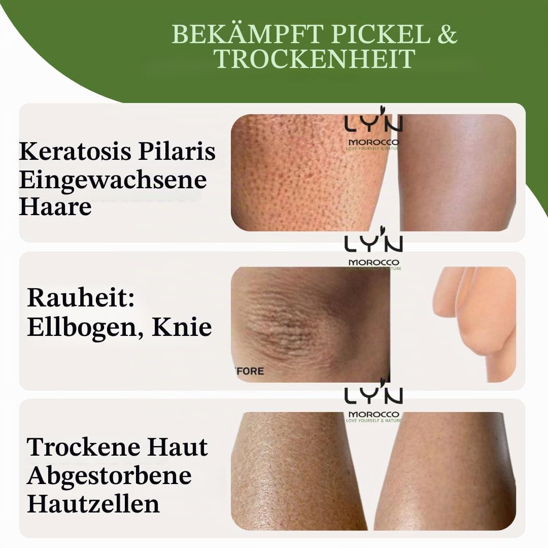 Ly'n Morocco TABRIMA SAHRAOUIA NILA und Weihrauch männlich Körpermaske Exfoliant für Knie, Ellbogen,