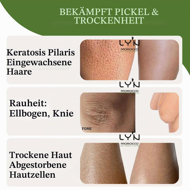 Ly'n Morocco TABRIMA SAHRAOUIA NILA und Weihrauch männlich Körpermaske Exfoliant für Knie, Ellbogen,