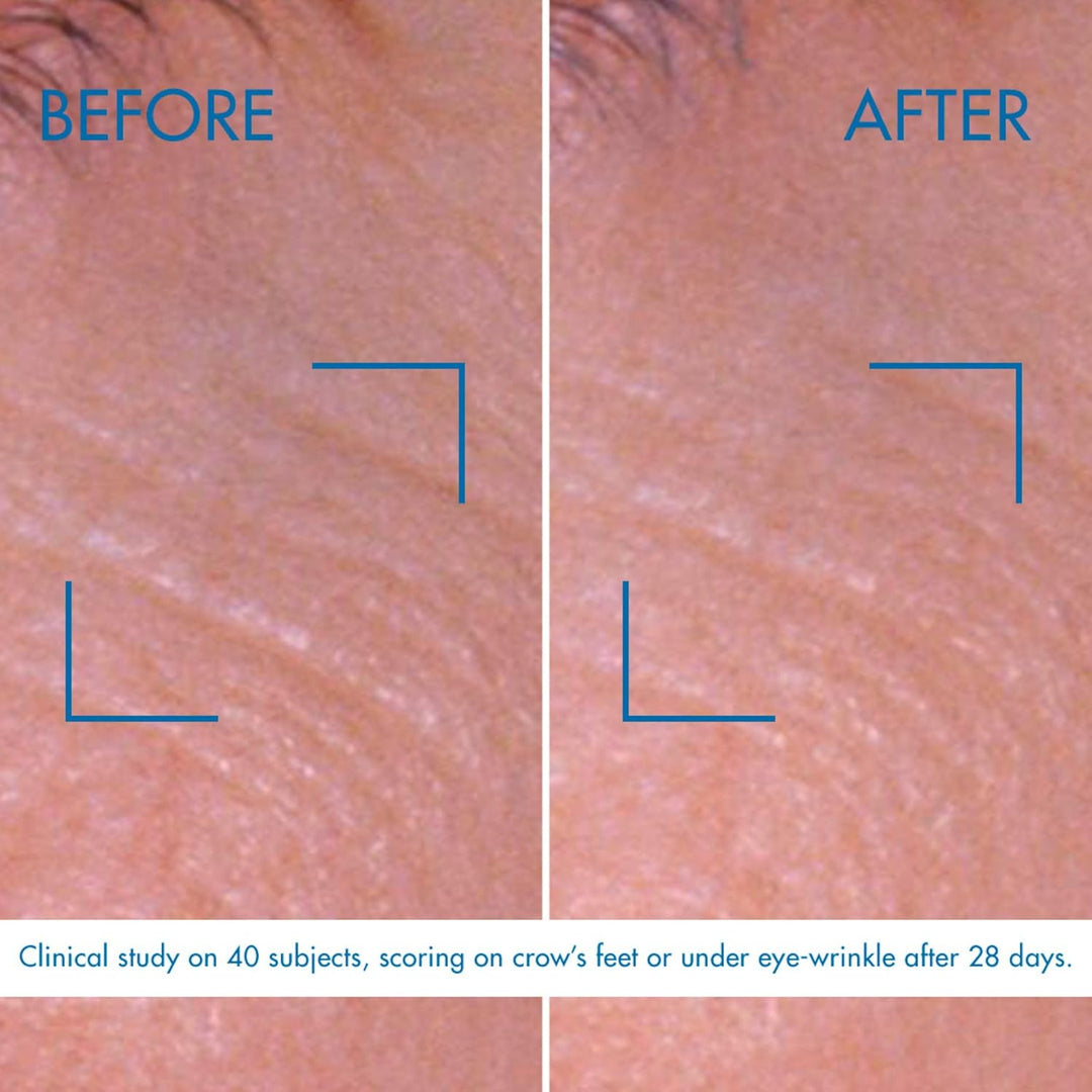Biotherm Pro-Retinol Augencreme, straffende Augencreme mit Life Plankton, glättende Augenpflege für