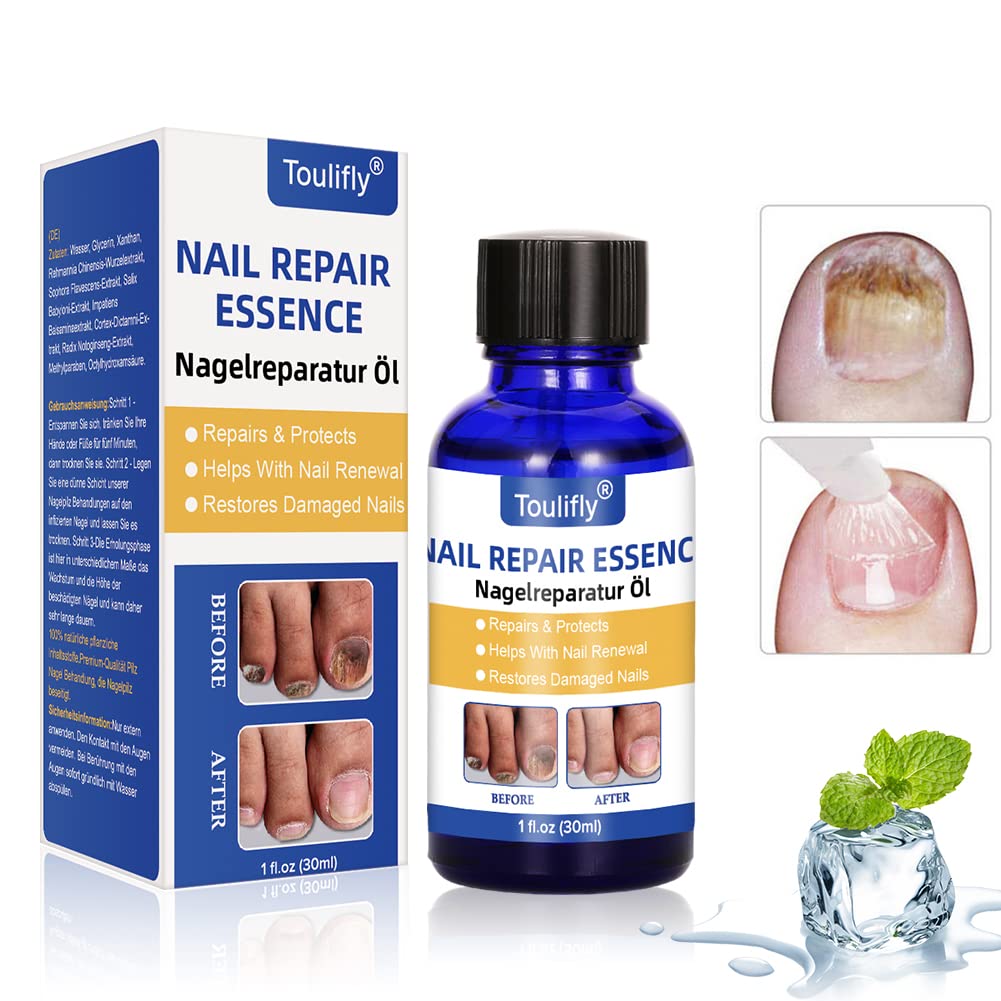 Nagelpflege und Behandlung, Nagelpflege für gesunde Fuss und Hand, Nagelpflegeöl,Nagelpflege pflegen
