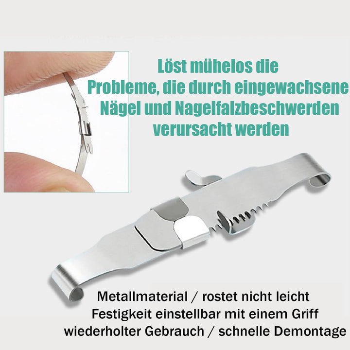 1 Satz Eingewachsene Zehennagel-Werkzeuge, Nagel-Korrekturschnalle, Patch Gebogene Zehennägel Klamme