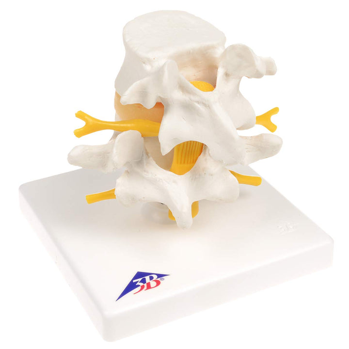 3B Scientific 3B Smart Anatomy Lendenwirbelsäule mit Bandscheibenvorfall + kostenlose Anatomie App -