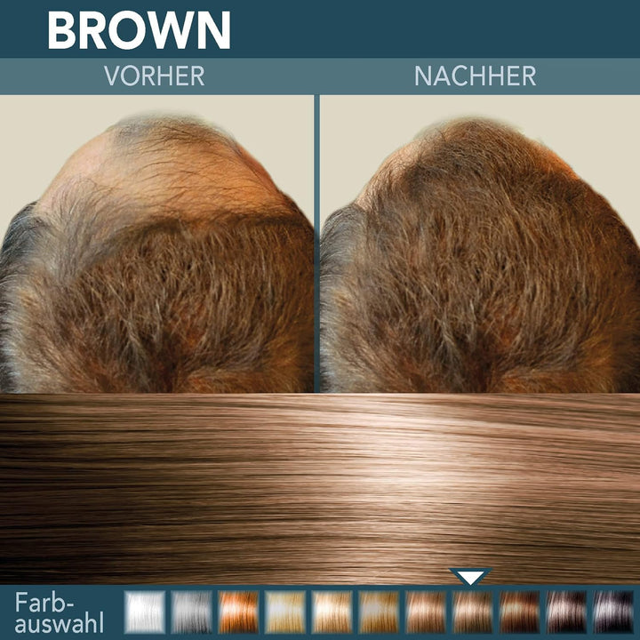 COVER HAIR - Premium Streuhaar 30g | Schütthaar zur Haarverdichtung und Ansatzkaschierung | Authenti